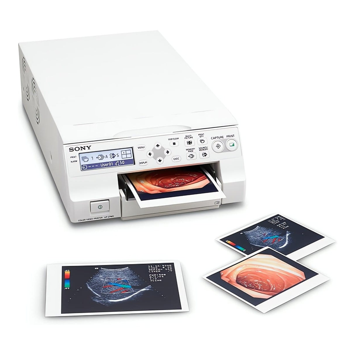 Sony Pro UP-27MD Medical Colour Video Printer